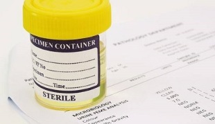 methods for diagnosing prostatitis